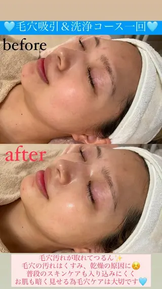 メンズ Salon de Lino 御器所のエステ・リラクイメージ