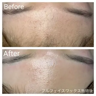 深い肌悩み専門 フェイシャルサロンのエステ・リラクイメージ