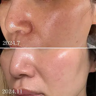 ハーブピーリング専門 グランディール　武内のエステ・リラクイメージ