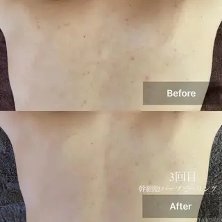 メンズ キッズ 美肌・リラクゼーションサロンLu,Mie所属・美肌と癒しのサロン Lu,Mieのエステ・リラクイメージ