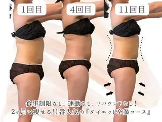 【目黒】本格痩身✴︎ 最新型よもぎ蒸しのエステ・リラクイメージ