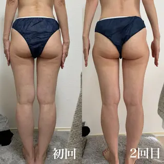 小顔リフトアップ 美肌改善専門店のエステ・リラクイメージ