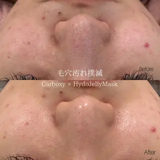 etre - 韓国肌管理 -のエステ・リラクイメージ