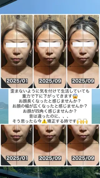 💎後悔させない小顔 矯正💎イトヤマ🌱のエステ・リラクイメージ