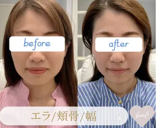 小顔/毛穴/ニキビ salon bealのエステ・リラクイメージ