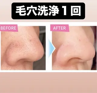 メンズ フルフィル名取美田園 MIYUKIのエステ・リラクイメージ