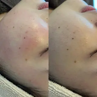 eye.所属・EYE. 村尾のマツエク・マツパデザイン