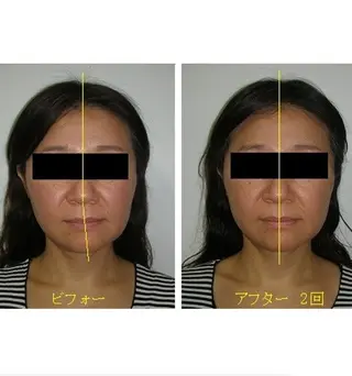 吉信 　のエステ・リラクイメージ