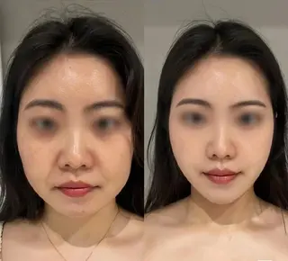 マツエク・マツパ aliaハーブ水光店 エステティシャン募集のエステ・リラクイメージ