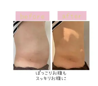 メンズ 癒し腸もみサロン シャユーム　ゆきなのその他イメージ