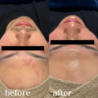 メンズ wax脱毛専門店 ハイラントのエステ・リラクイメージ