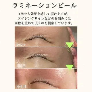 hue.所属・hue. YUKAのエステ・リラクイメージ