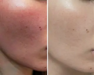 Sha.Lu.Lu.所属・本気の肌質改善/ ハーブピーリングのエステ・リラクイメージ