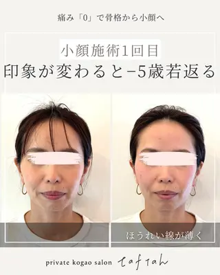 小顔   目元専門 taftahタフタのマツエク・マツパデザイン