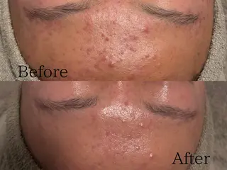 lumirise所属・lumi riseのエステ・リラクイメージ