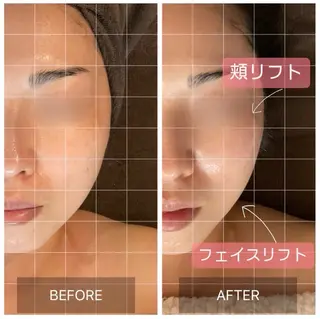 MIRAI小顔 広島駅前店のエステ・リラクイメージ