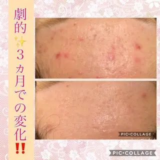 ショート カラー パーマ ヘアアレンジ メンズ キッズ ネイル マツエク・マツパ ニキビ・肌質改善専門 ♡人生が変わるサロンのエステ・リラクイメージ