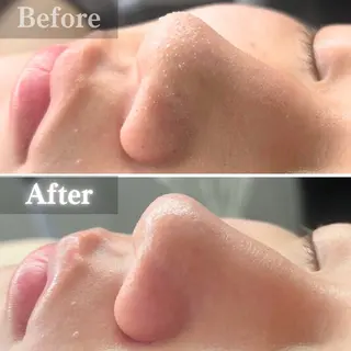 毛穴洗浄特化🫧 オオツカのエステ・リラクイメージ