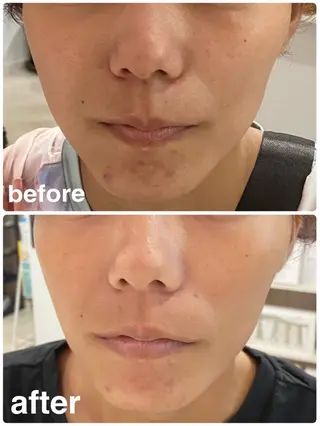 Beauty Salon Lunaのエステ・リラクイメージ