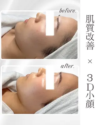 LiAm《美肌管理/ 小顔/脂肪ケア》のその他イメージ