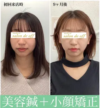 ハリサロンドオフ 美容鍼灸×小顔整体のエステ・リラクイメージ