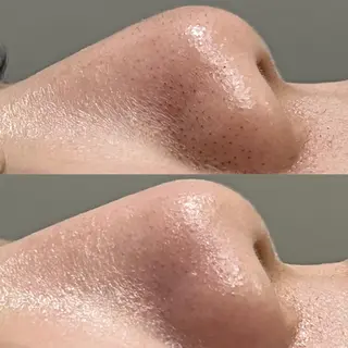 LICO_NEE_ yukikoのエステ・リラクイメージ