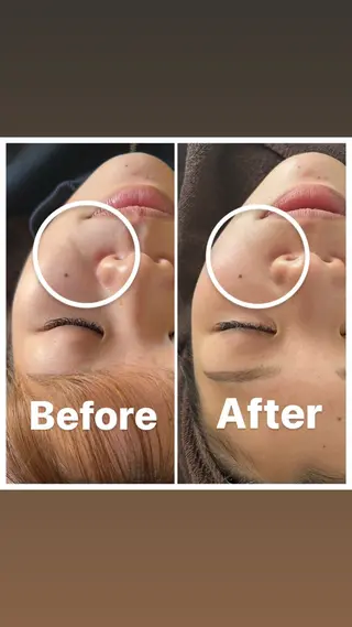 肌質改善・小顔サロン 20代店長RINNAのエステ・リラクイメージ