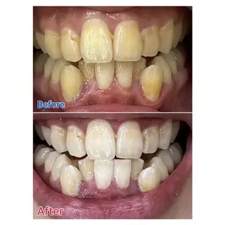 Ｍ渋谷 ホワイトニングのエステ・リラクイメージ