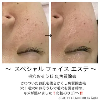 ビューティー ミロワールのエステ・リラクイメージ