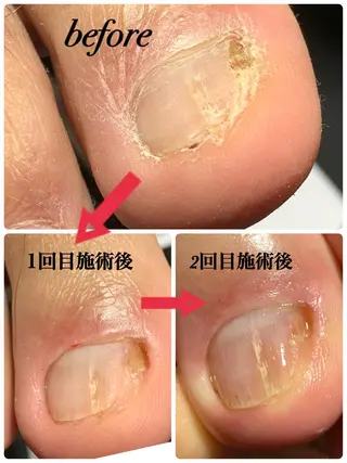 ネイル 【メンズサロン】 MARCAのエステ・リラクイメージ