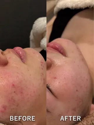 💎美容革命ラボ💎 大名店のエステ・リラクイメージ