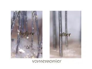 マツエク・マツパ Vorne Monterのマツエク・マツパデザイン