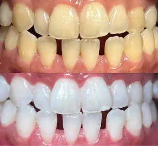 io teeth careのその他イメージ