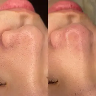 E LINDAのネイルデザイン