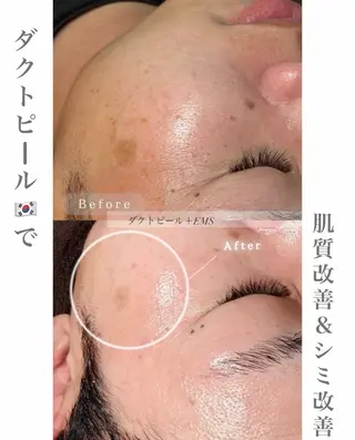 chouchou【シュシュ】所属・トータルボディケア chouchouのエステ・リラクイメージ