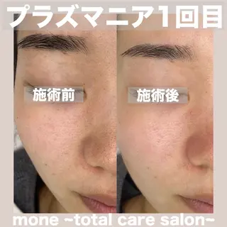 mone~total care salon~所属・mone (モーネ)のエステ・リラクイメージ