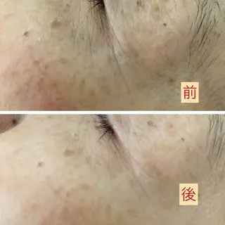 たるみ改善小顔エステ 堀葉月のその他イメージ