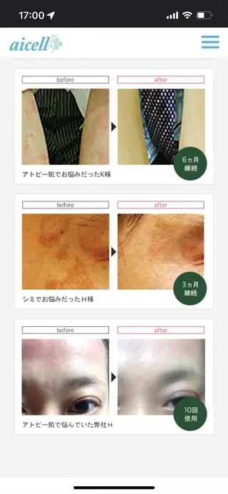 肌質改善 ルポエトワのエステ・リラクイメージ