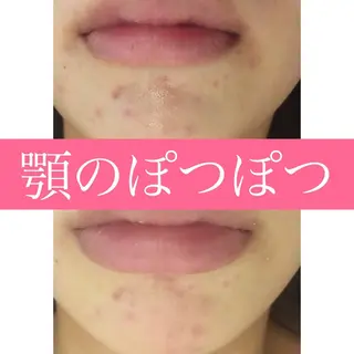 セミロング パーマ ヘアアレンジ メンズ マツエク・マツパ 金の糸脱毛 産毛ケア専門のエステ・リラクイメージ