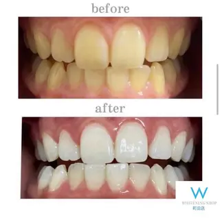 メンズ キッズ ホワイトニング ショップ町田店のその他イメージ