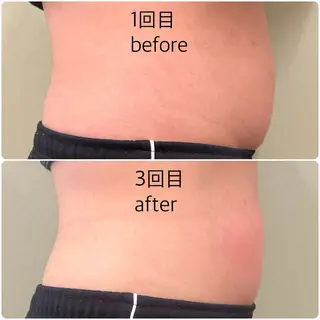 メンズ ほねつぎ一休さん 宇品店のエステ・リラクイメージ