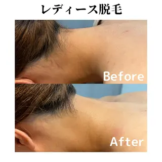 トータルビューティー サロンSalaのマツエク・マツパデザイン