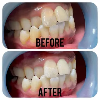 two nailのネイルデザイン