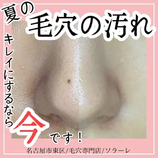  毛穴洗浄・まつ毛 の専門店 ソラーレのエステ・リラクイメージ