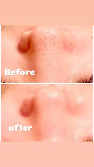 肌質改善サロン 来店プレゼントありのエステ・リラクイメージ