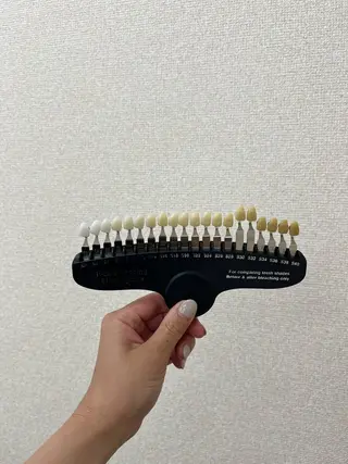 セルフホワイトニング エクシア小山店のその他イメージ