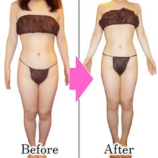 ダイエットラボ梅田店 🌟のエステ・リラクイメージ