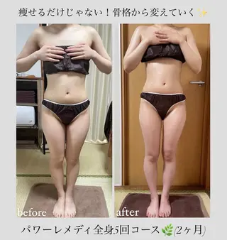 《本気痩せ×疲労改善 》  BILOOPのエステ・リラクイメージ