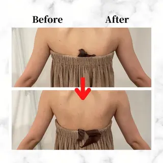 12Dハイフ💗 最強小顔のエステ・リラクイメージ