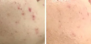 角栓取り専門エステ ベテラン講師幸田のエステ・リラクイメージ